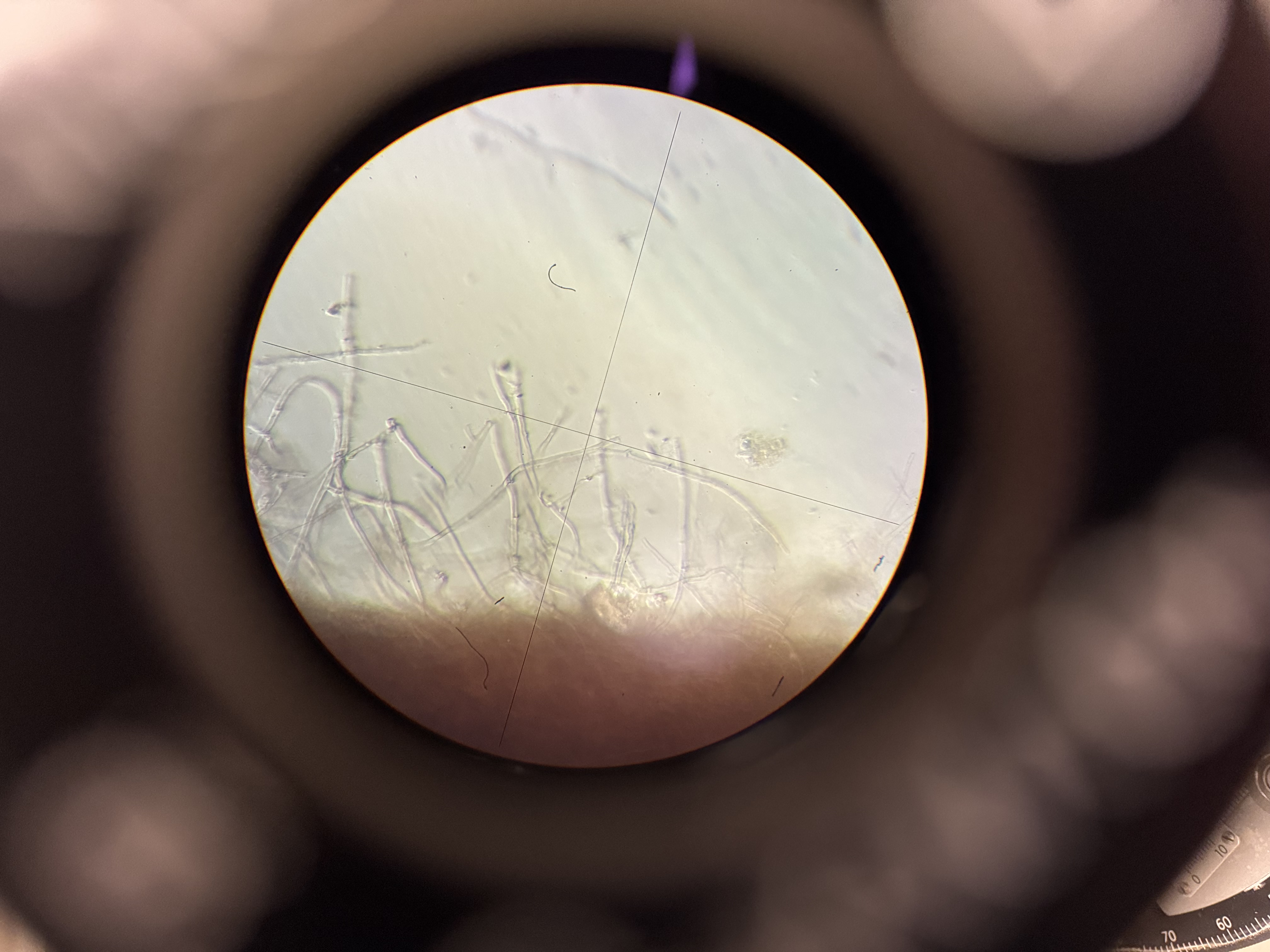 photo of fungal hyphae filaments under a microscope